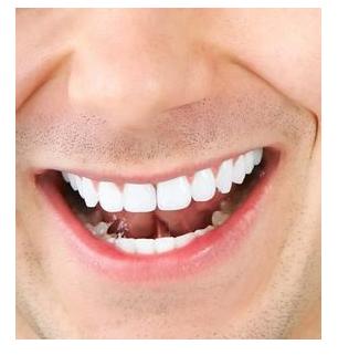 牙齿大的人面相_男生牙齿稀疏牙缝大面相_面相看人生牙齿