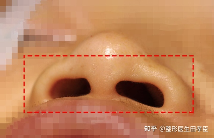 ​的鼻子有什么标准？的正面和侧面衡量