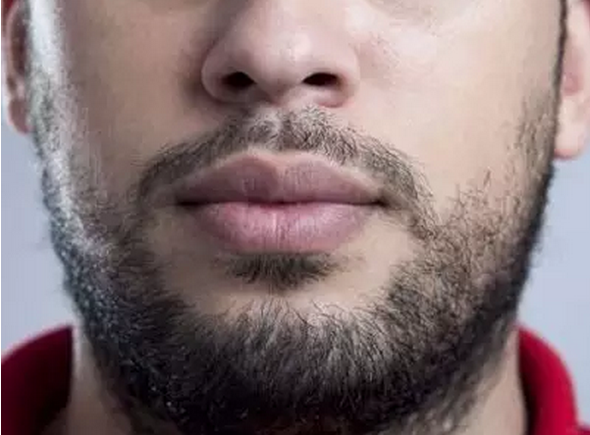 促进胡须生长的方法怎么让胡子长得浓密，值得一看！
