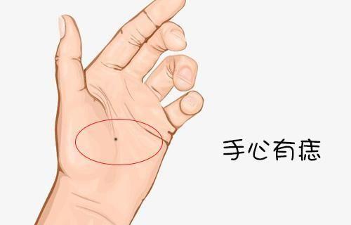 四个角度来看左掌心有痣代表了什么 掌心痣代表什么意思