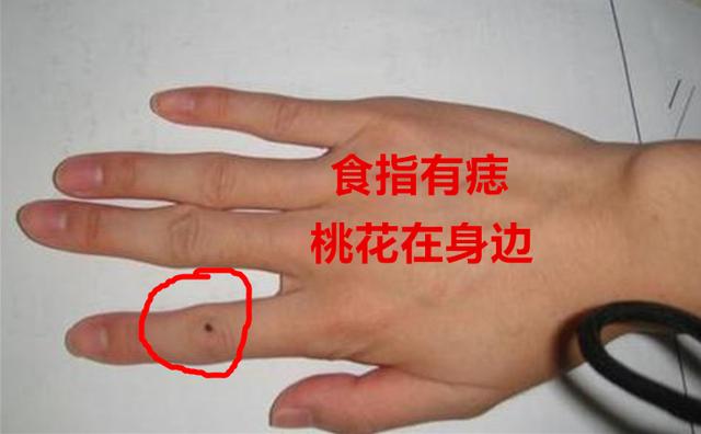 （李向东）拇指和食指虎口处有痣代表什么？