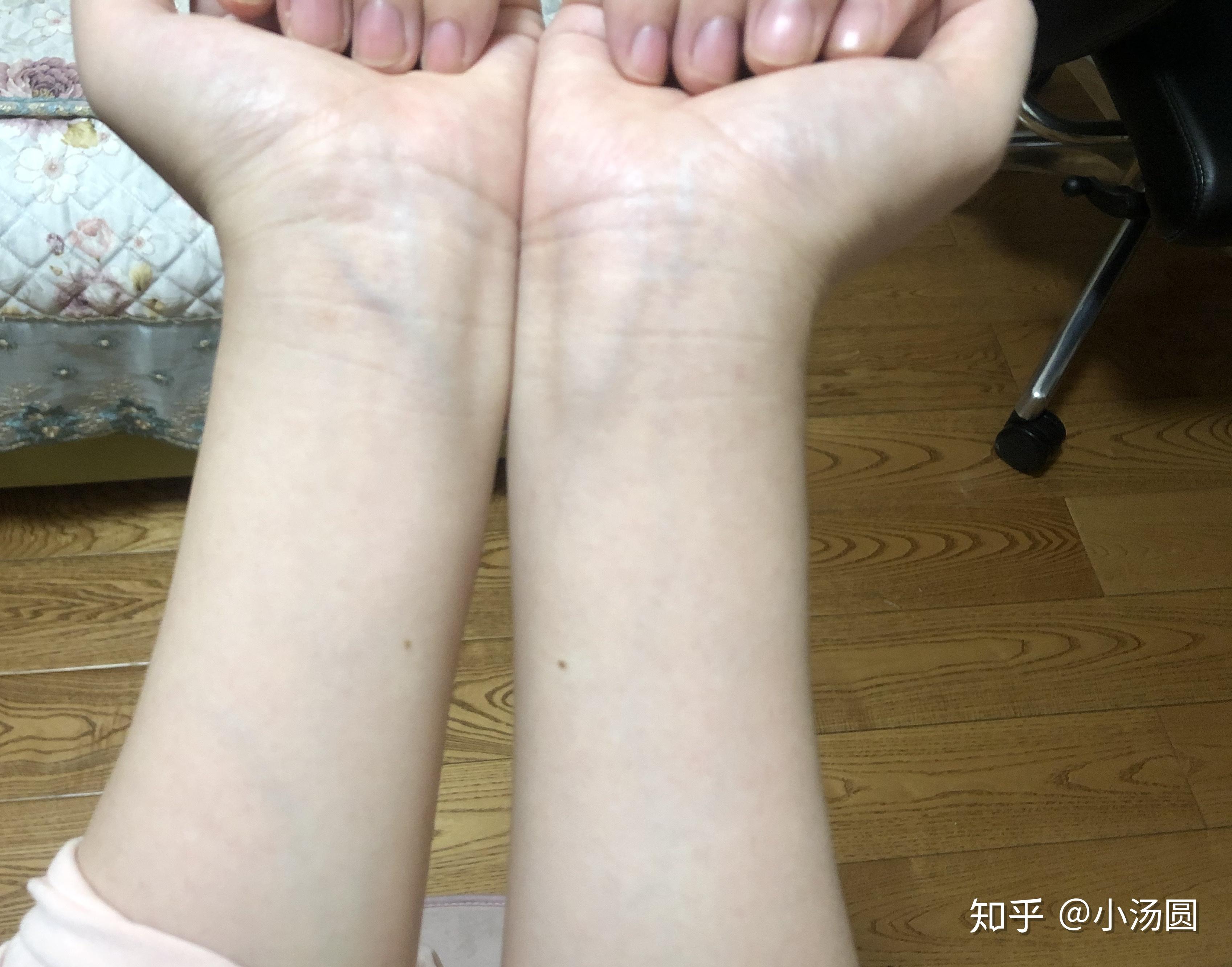 （李向东）女人手臂上有痣代表什么？有你吗？