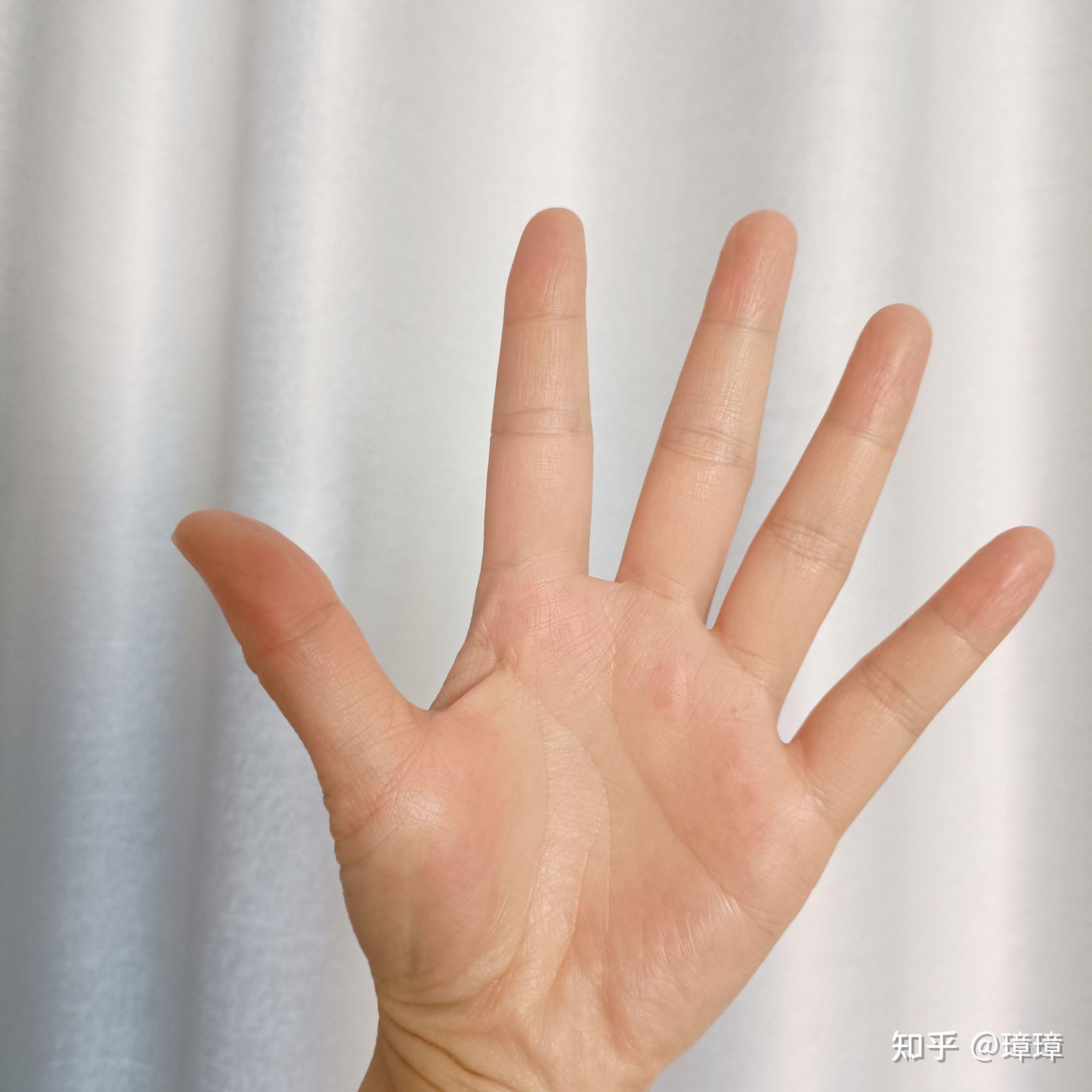 手指痣长在手上有什么含义？右手中指有痣的男人什么命