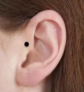 耳朵上有颗痣代表聪明，指纹有两个完好的圈代表富贵